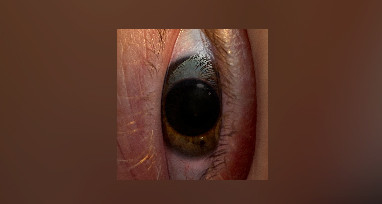 Минаева - Шоколадка (Remixes)